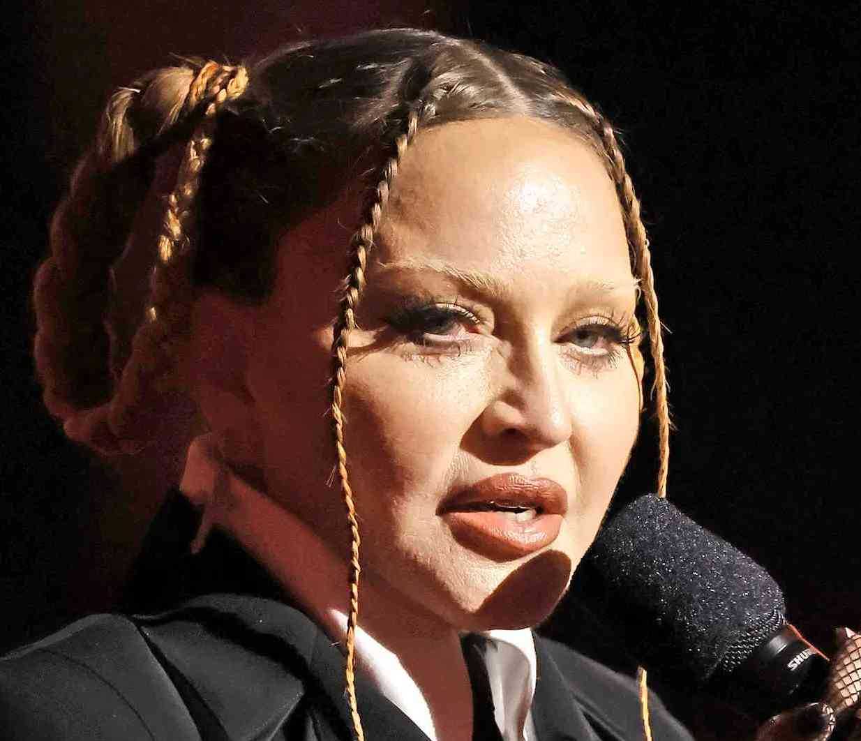 Madonna ai Grammy si presenta con il viso deformato fan preoccupati