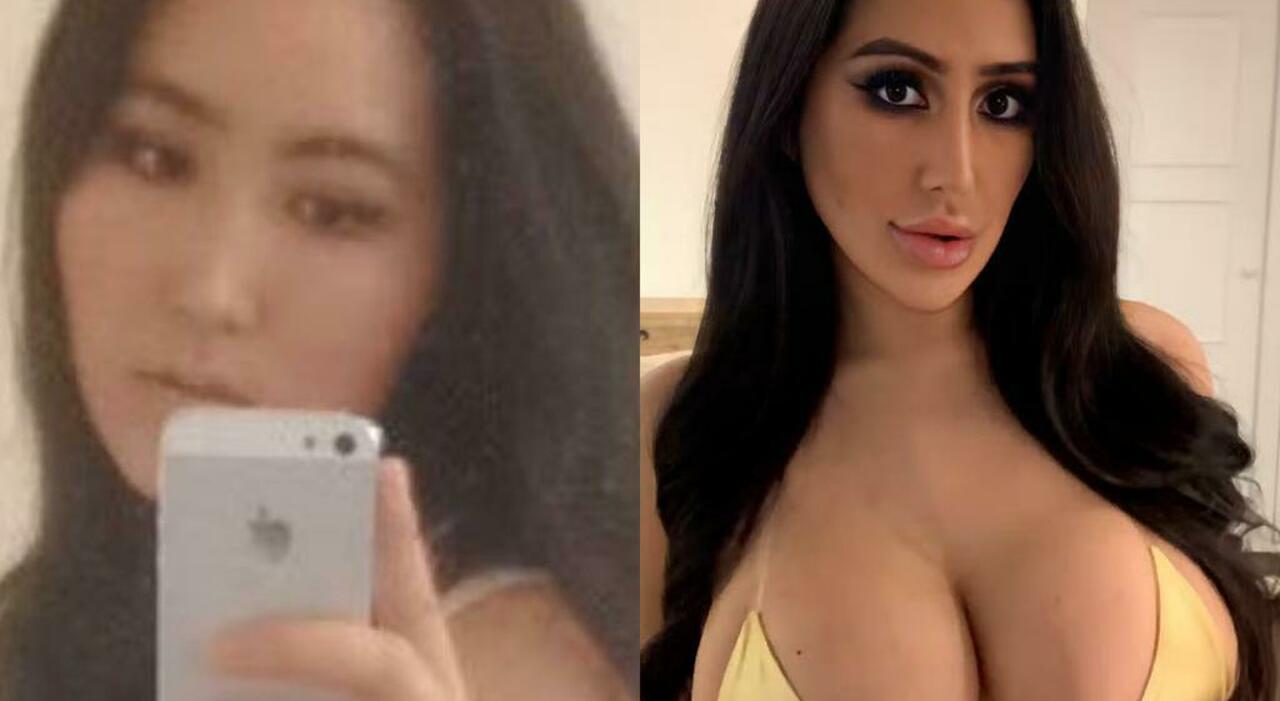 Â«Voglio essere uguale a Kim KardashianÂ», la pazzia della ragazza sudcoreana: ha speso 60mila euro in chirurgia