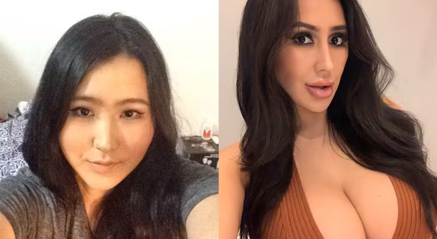 Â«Voglio essere uguale a Kim KardashianÂ», la pazzia della ragazza sudcoreana: ha speso 60mila euro in chirurgia